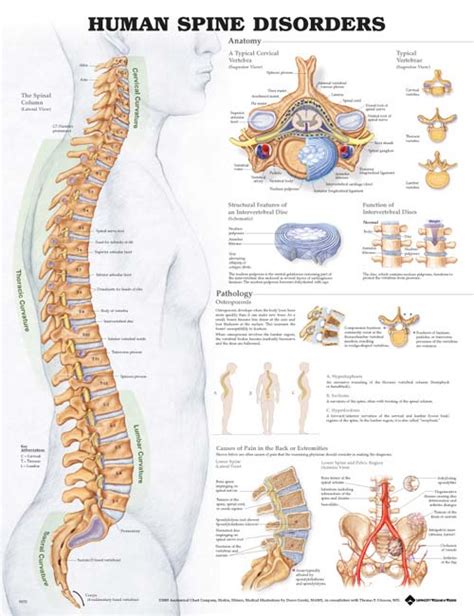 The Human Spine Disorders Chart - MedWest Medical Supplies