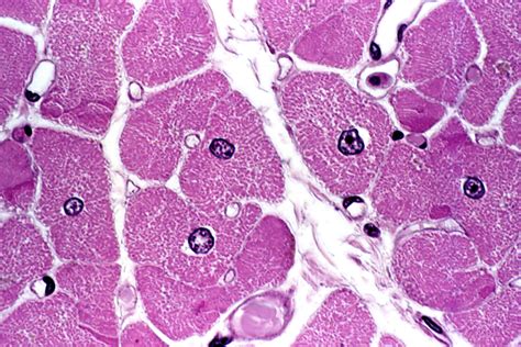 Piloerector Muscle Histology