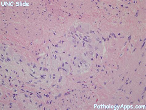 ganglion cells large intestine histology