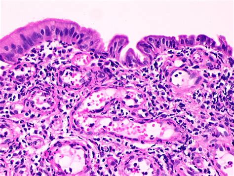 Histopathology of the uterine cervix - digital atlas