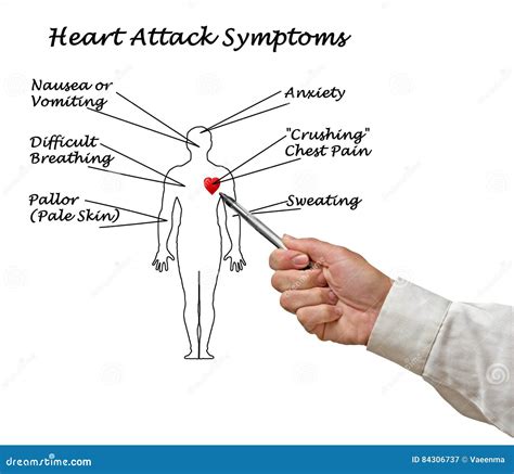 Heart Attack. Symptoms Vector Illustration | CartoonDealer.com #92530502