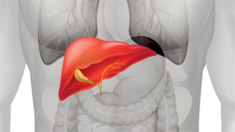 What You Need to Know About Psoriasis and Liver Disease