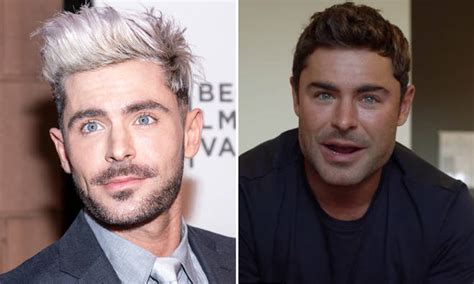 Zac Efron Explains Shattered Jaw Left His Face Swollen Last Year - Capital