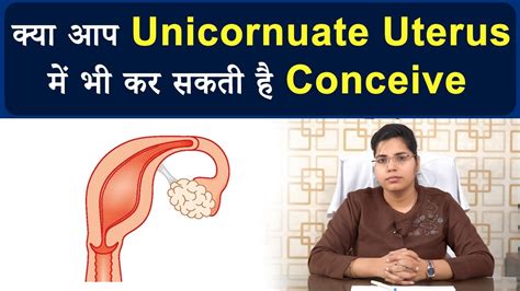 What is Unicornuate Uterus और Pregnancy पर इसका असर - Dr Chanchal Sharma - YouTube