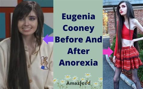 Eugenia Cooney Before And After Anorexia | More About Cooney » Amazfeed