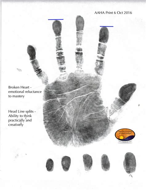 Line of Clairvoyance Archives - American Academy of Hand Analysis