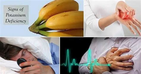 Potassium Deficiency, Signs and Symptoms To Watch Out For - Healthy Holistic Living