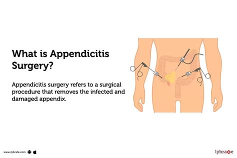 Appendicitis Surgery: Purpose, Procedure, Benefits and Side Effects