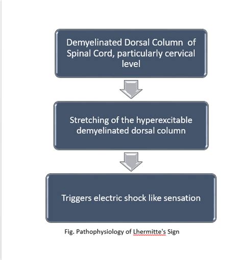 Lhermitte's Sign - Physiopedia