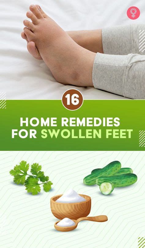 17 home remedies for swollen feet symptoms and treatments – Artofit