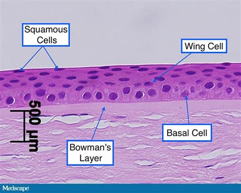 Corneal Abrasions: Managing a Commonly Occurring Injury