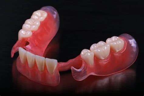 Valplast® Translucent Flexible Clasps | Keating Dental Lab