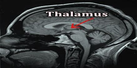 About Thalamus - Assignment Point