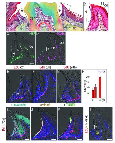 The junctional epithelium (JE) is a high-turnover tissue. (A ...