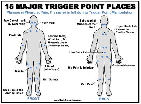 Plainsure: How to Deal with Trigger Points | Bear With Me | Trigger points, Trigger point ...