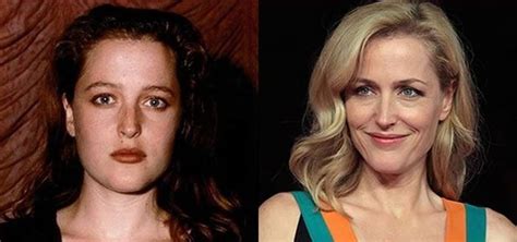 The Right Kind of Changes from Gillian Anderson’s Plastic Surgery | Go Away Paris!