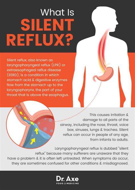 12 Natural Ways to Relieve Silent Reflux Symptoms | Herbs Advisor