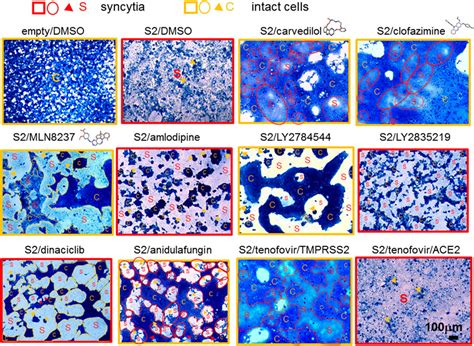 Frontiers | Fusion assays for screening of fusion inhibitors targeting SARS-CoV-2 entry and ...