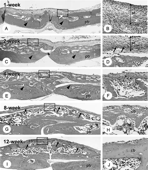 Chronology of the histological events following DeltaSystem ® plate ...