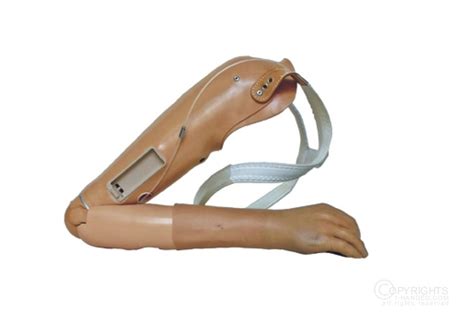 Hand Prosthesis Artificial Hand at Rs 25000 | Body Part Silicone ...