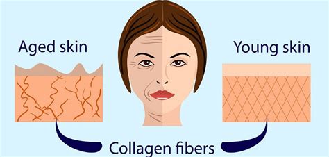 Collagen - How It Works - Injections Cost, Results & Side Effects