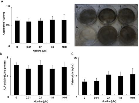 Increased expression of Cathepsin B in oral squamous cell carcinoma ...