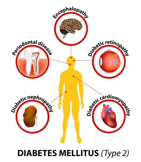 Cardiorrenal.es | Cuidado de órganos diana