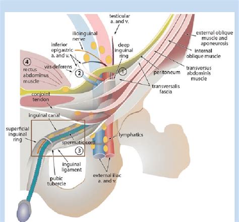 Diagram of the inguinal canal (IC) and its contents. The deep inguinal ...