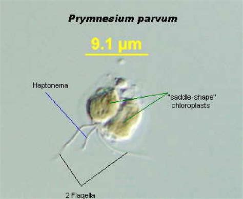 A microscopic picture of a golden alga cell (1000X magnification).... | Download Scientific Diagram