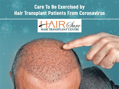 Care to be Exercised by Hair Transplant Patients From Coronavirus - Cyber Hairsure