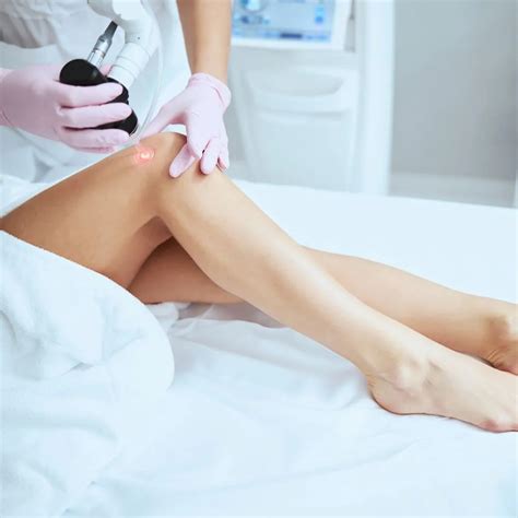 Laser Treatment for Spider Veins in San Diego | Effective & Safe Solutions