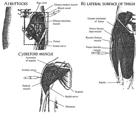 Anabolic Steroid Site Injections | IronMag Bodybuilding Blog