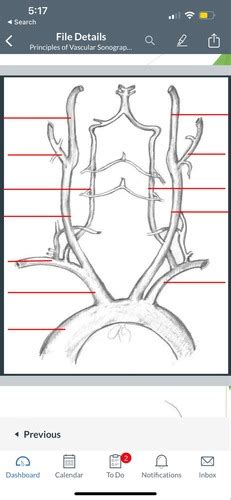 Carotid Duplex (anatomy & protocol) (test 1) Flashcards | Quizlet