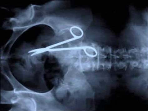 31 Funny X-Ray Images That Seem Too Ridiculous To Be Real