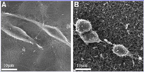 Scanning electron micrographs of Schwann cells grown on 2D surfaces of... | Download Scientific ...