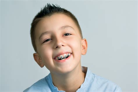 Scared Straightened: How to Prepare Kids Getting Braces