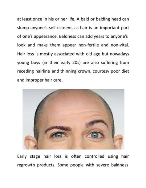 Side Effects of Hair Regrowth Products