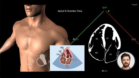 Apical 4 Chamber - YouTube