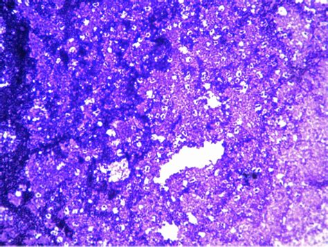 NEGATIVE STAIN – Red Mountain Microbiology