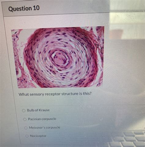 Solved Question 10 What sensory receptor structure is this? | Chegg.com