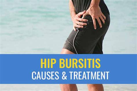 Hip bursitis – Causes and treatment