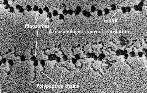 Ribosomes | Celebrate Cytochemistry | Gwen V. Childs, Ph.D.