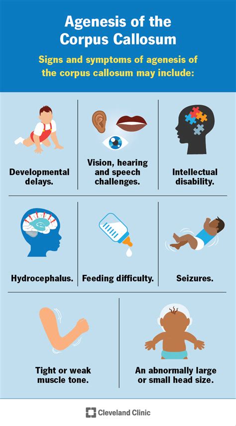 Agenesis of the Corpus Callosum: Symptoms & Treatment