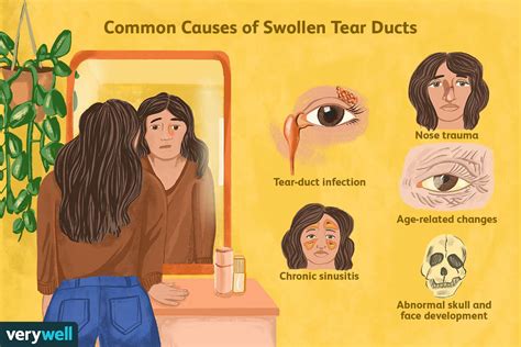 Swollen Tear Duct: Why It Happens and How to Treat It