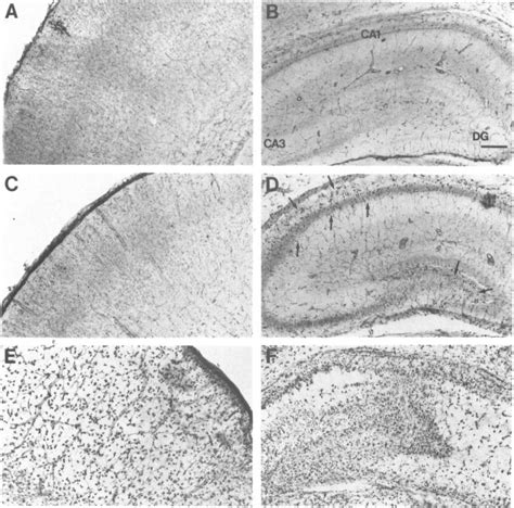 Effect of hypoxia and hypoxia-ischemia on brain HO-1 expression in... | Download Scientific Diagram