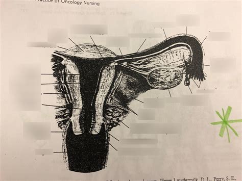 Cross Section of Uterus Diagram | Quizlet