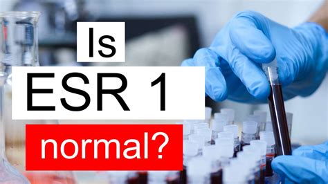 Is ESR 1 normal, high or low? What does ESR level 1 mean?