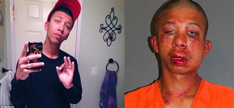 Wonder Why This 18 Year Old Was Beaten Senseless? - Gallery | eBaum's World