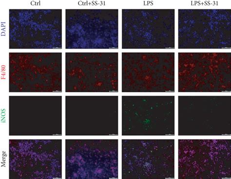 SS-31 downregulated LPS-induced macrophage polarization in vitro. (a ...