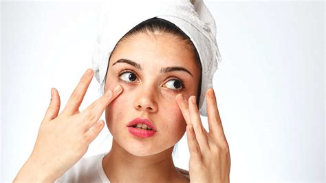 5 Tips to Treat Dry Skin this Winter - On Check by PriceCheck